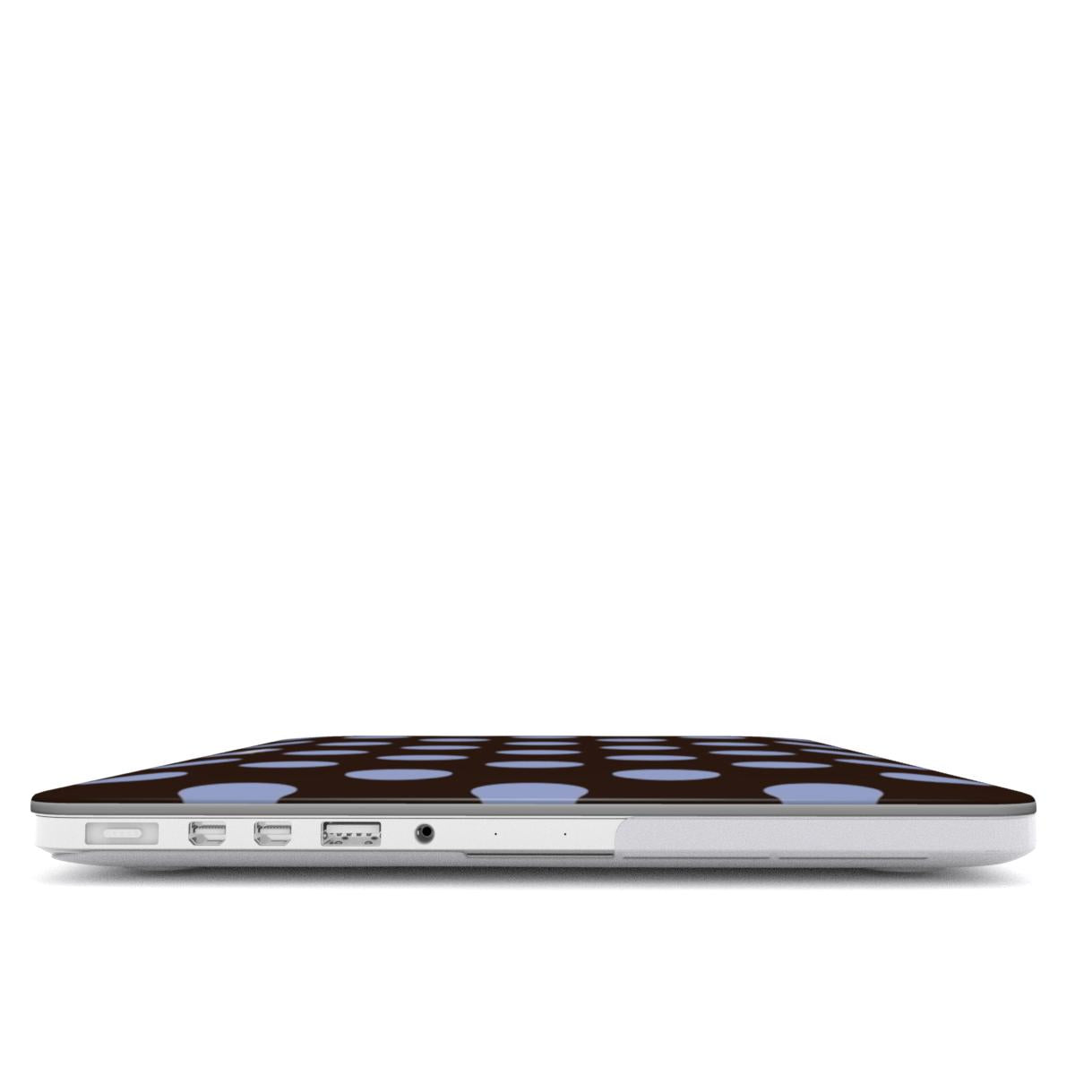 CHOCO BLUE - MacBook Case